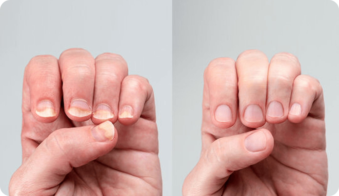 Before After Fingers